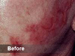 skin_before