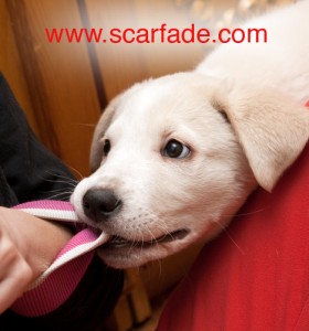 How to Minimize Dog Bite Scars - Scarfade