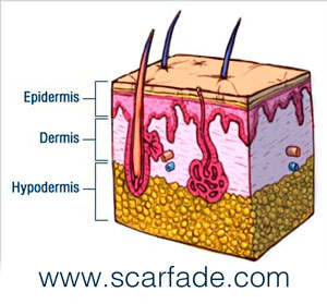 why scars form