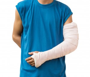 Broken Arm